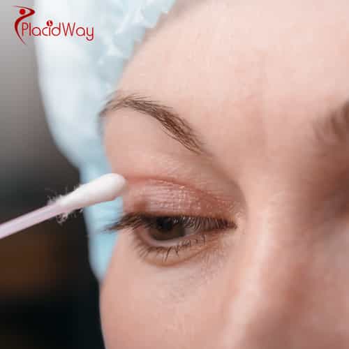 Eyelid Surgery in Turkey: Cost and Clinic Comparison for Brits